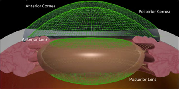 Catalys 3D imagery